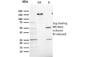 SDS-PAGE Analysis Purified Ki67 Mouse Monoclonal Antibody (MKI67/2466). (Ki-67 antibody  (AA 2293-2478))