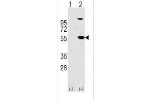 Western blot analysis of ALDH1A1 using rabbit polyclonal ALDH1A1 Antibody using 293 cell lysates (2 ug/lane) either nontransfected (Lane 1) or transiently transfected with the ALDH1A1 gene (Lane 2).