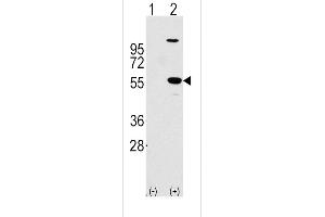 Western blot analysis of ALDH1A1 using rabbit polyclonal ALDH1A1 Antibody using 293 cell lysates (2 ug/lane) either nontransfected (Lane 1) or transiently transfected with the ALDH1A1 gene (Lane 2). (ALDH1A1 antibody  (AA 302-331))