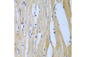 Immunohistochemistry of paraffin-embedded rat heart using MGAT3 antibody. (MGAT3 antibody  (AA 364-533))