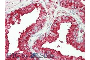 IHC-P analysis of Human Prostate Gland Tissue, with HE staining. (CPT1A antibody  (AA 191-353))