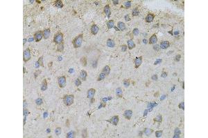Immunohistochemistry of paraffin-embedded Mouse brain using DBI Polyclonal Antibody at dilution of 1:100 (40x lens). (Diazepam Binding Inhibitor antibody)
