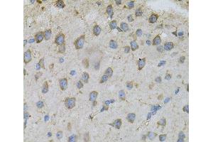 Immunohistochemistry of paraffin-embedded Mouse brain using DBI Polyclonal Antibody at dilution of 1:100 (40x lens).