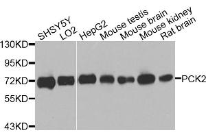 Western blot analysis of extracts of various cell lines, using PCK2 antibody. (PEPCK antibody)
