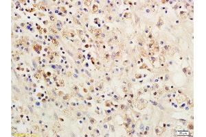 Formalin-fixed and paraffin embedded: rat brain tissue labeled with Anti-SOCS 1 Polyclonal Antibody , Unconjugated 1:200 followed by conjugation to the secondary antibody and DAB staining (SOCS1 antibody  (AA 121-211))