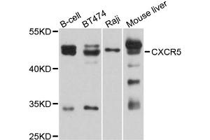 Western blot analysis of extracts of various cell lines, using CXCR5 antibody (ABIN2736602) at 1:1000 dilution. (CXCR5 antibody)