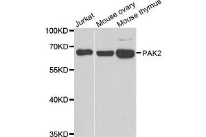 Western blot analysis of extracts of various cell lines, using PAK2 antibody. (PAK2 antibody)