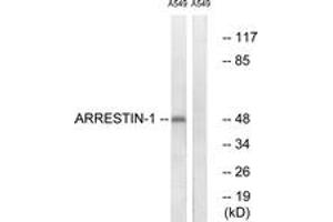 Western blot analysis of extracts from A549 cells, treated with Etoposide 25uM 60', using Arrestin 1 (Ab-412) Antibody.