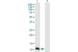 Western Blot analysis of NPHP1 expression in transfected 293T cell line by NPHP1 MaxPab polyclonal antibody. (NPHP1 antibody  (AA 1-121))