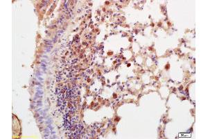 Formalin-fixed and paraffin embedded mouse lung labeled with Anti-Prostaglandin E Receptor EP2 Polyclonal Antibody, Unconjugated (ABIN755248) at 1:200 followed by conjugation to the secondary antibody and DAB staining. (PTGER2 antibody  (AA 271-358))