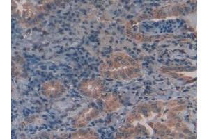 Immunohistochemistry (IHC) image for anti-Galactosidase, alpha (GLA) (AA 1-80) antibody (ABIN7437761)