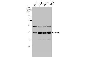 WB Image Various whole cell extracts (30 μg) were separated by 10% SDS-PAGE, and the membrane was blotted with RAP antibody [N1C3] , diluted at 1:1000. (LRPAP1 antibody  (Center))