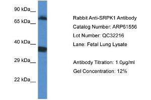 Western Blotting (WB) image for anti-SRSF Protein Kinase 1 (SRPK1) (C-Term) antibody (ABIN2788838) (SRPK1 antibody  (C-Term))