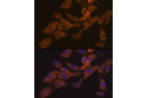 Immunofluorescence analysis of NIH-3T3 cells using KIF3A Rabbit mAb (ABIN7268132) at dilution of 1:100 (40x lens). (KIF3A antibody)