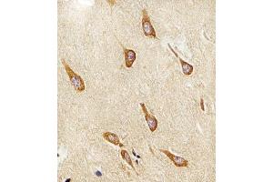 Immunohistochemistry (Paraffin-embedded Sections) (IHC (p)) image for anti-Platelet-Activating Factor Acetylhydrolase 1b, Regulatory Subunit 1 (45kDa) (PAFAH1B1) (AA 76-110), (N-Term) antibody (ABIN6243934)