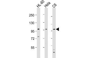 All lanes : Anti-NCSTN Antibody (N-Term) at 1:8000 dilution Lane 1: HL-60 whole cell lysates Lane 2: Hela whole cell lysates Lane 3: C6 whole cell lysates Lysates/proteins at 20 μg per lane. (Nicastrin antibody  (AA 99-133))