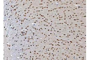 IHC analysis of THAP11 using anti-THAP11 antibody (ABIN7599230). (THAP11 antibody  (AA 1-294))