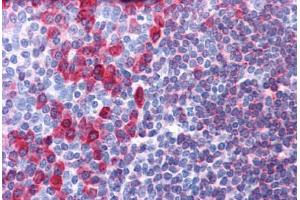 Human Tonsil: Formalin-Fixed, Paraffin-Embedded (FFPE) (CD79a antibody  (AA 202-216))