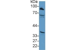 Detection of CPT1A in Human Hela cell lysate using Polyclonal Antibody to Carnitine Palmitoyltransferase 1A, Liver (CPT1A) (CPT1A antibody  (AA 191-353))