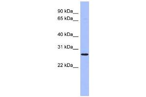 WB Suggested Anti-HOXA6 Antibody Titration:  0.