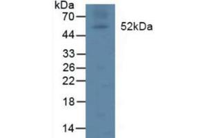 Detection of LPL in Rat Lymph Node Tissue using Polyclonal Antibody to Lipoprotein lipase (LPL) (Lipoprotein Lipase antibody  (AA 55-316))