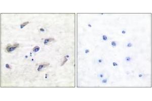 Immunohistochemistry analysis of paraffin-embedded human brain, using Tau (Phospho-Ser356) Antibody.