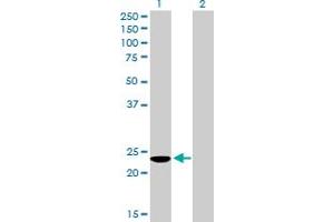 Western Blot analysis of COMMD3 expression in transfected 293T cell line by COMMD3 MaxPab polyclonal antibody. (COMMD3 antibody  (AA 1-195))