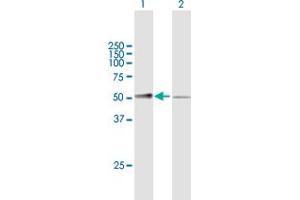 Western Blot analysis of MASP1 expression in transfected 293T cell line by MASP1 MaxPab polyclonal antibody. (MASP1 antibody  (AA 1-380))