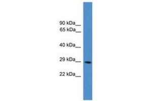 Image no. 1 for anti-Protein Kinase, CAMP Dependent, Catalytic, beta (PRKACB) (N-Term) antibody (ABIN6745502) (PRKACB antibody  (N-Term))