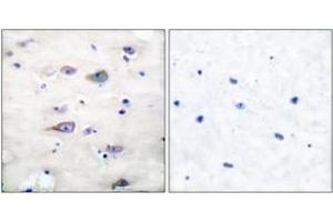 Immunohistochemistry analysis of paraffin-embedded human brain, using GluR2 (Phospho-Ser880) Antibody.