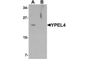 Western blot analysis of YPEL4 in SW480 cell lysate with YPEL4 antibody at 1 ug/mL in (A) the absence and (B) the presence of blocking peptide. (YPEL4 antibody  (N-Term))