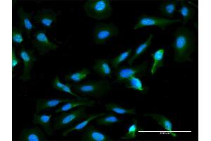 Immunofluorescence of monoclonal antibody to HN1L on HeLa cell. (HN1L antibody  (AA 1-190))