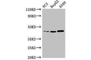 Western Blot Positive WB detected in: PC-3 whole cell lysate, HepG2 whole cell lysate, A549 whole cell lysate All lanes: DNMT3L antibody at 3. (DNMT3L antibody  (AA 1-234))