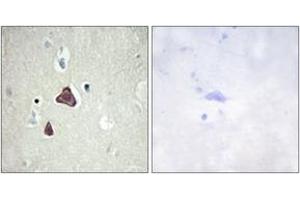 Immunohistochemistry (IHC) image for anti-Adenylate Cyclase 8 (Brain) (ADCY8) (AA 591-640) antibody (ABIN2889854) (ADCY8 antibody  (AA 591-640))