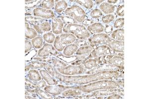 Immunohistochemistry of paraffin-embedded mouse kidney using SNRPD1 Rabbit pAb (ABIN7270363) at dilution of 1:50 (40x lens). (SNRPD1 antibody  (AA 1-100))