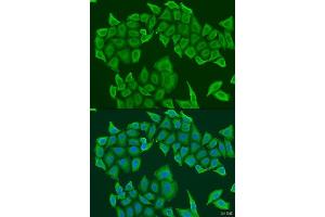 Immunofluorescence analysis of U2OS cells using HAUS8 antibody. (NYS48/HAUS8 antibody  (AA 166-410))