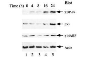 Image no. 2 for anti-Zinc Finger Protein 148 (ZNF148) antibody (ABIN299225) (ZNF148 antibody)