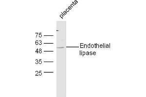 Mouse placenta lysates probed with Anti-Endothelial lipase Polyclonal Antibody, Unconjugated  at 1:5000 90min in 37˚C. (LIPG antibody  (AA 301-400))