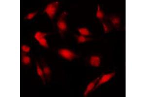 ABIN6269222 staining NIH-3T3 by IF/ICC. (Merlin antibody  (C-Term))