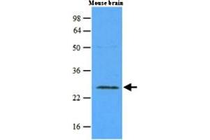 Western blot analysis of mouse brain extracts (45 ug) were resolved by SDS - PAGE , transferred to NC membrane and probed with RAB5A monoclonal antibody , clone 3A4 (1 : 500) . (RAB5 antibody)