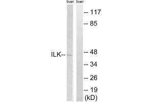 Western blot analysis of extracts from rat liver cells, using ILK (epitope around residue 246) antibody.