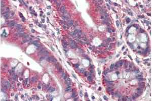 ABIN571280 (5µg/ml) staining of paraffin embedded Human Small Intestine. (RUFY1 antibody  (Internal Region))