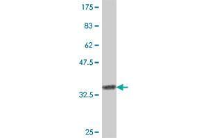 Western Blot detection against Immunogen (35. (CD3G antibody  (AA 23-111))