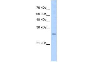 WB Suggested Anti-SOX15 Antibody Titration:  2. (SOX15 antibody  (N-Term))