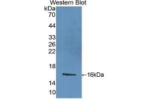 Detection of Recombinant LIMCH1, Mouse using Polyclonal Antibody to LIM And Calponin Homology Domains Containing Protein 1 (LIMCH1) (LIMCH1 antibody  (AA 21-125))