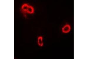 Immunofluorescent analysis of FRZB staining in A549 cells. (FRZB antibody)