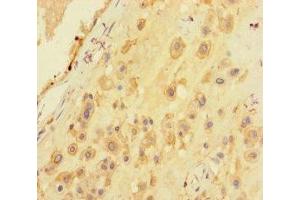 Immunohistochemistry of paraffin-embedded human placenta tissue using ABIN7168949 at dilution of 1:100 (Seryl-tRNA Synthetase (SARS) (AA 2-233) antibody)