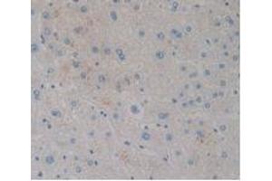 IHC-P analysis of Human Liver Tissue, with DAB staining. (CCK8 antibody)