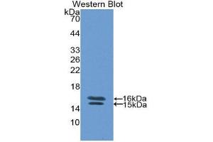Western Blotting (WB) image for anti-Vasoactive Intestinal Peptide (Vip) (AA 29-165) antibody (ABIN1860941) (Vip antibody  (AA 29-165))