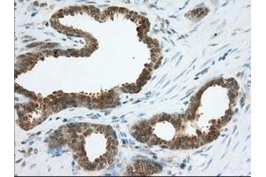 Immunohistochemical staining of paraffin-embedded Human Kidney tissue using anti-ACAT2 mouse monoclonal antibody. (ACAT2 antibody)